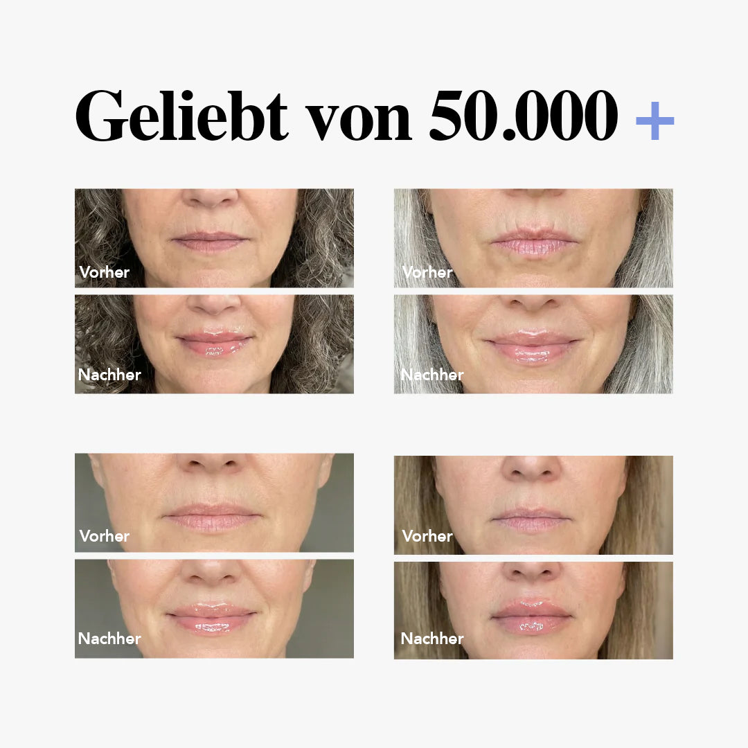 Læbeserum